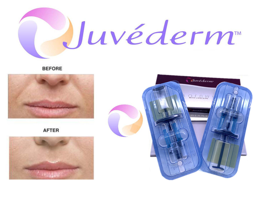крест 2x1ml соединил заполнитель Juvederm дермальный для завалки морщинки стороны