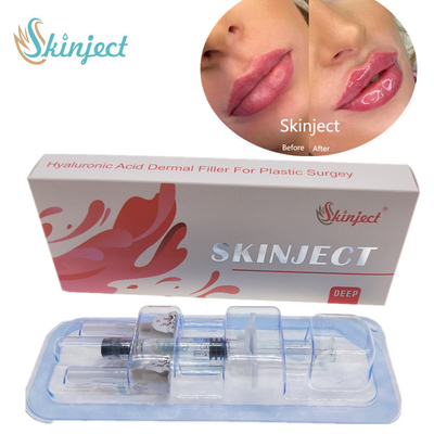 Заполнители губ 2ml Skinject глубокие Hyaluronic кисловочные дермальные вводимые