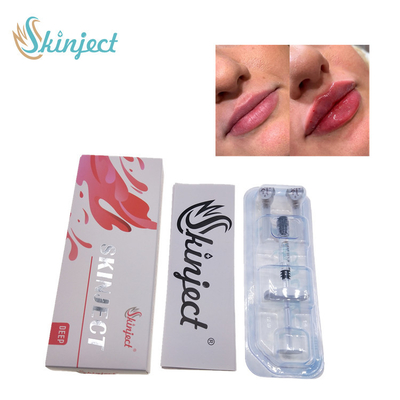 Заполнители губ 2ml Skinject глубокие Hyaluronic кисловочные дермальные вводимые