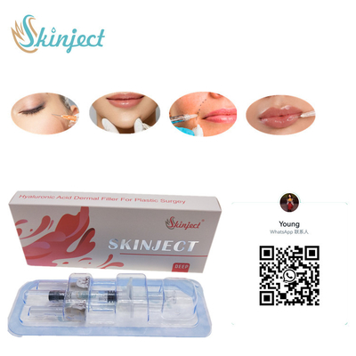 Створка Chin вводимой щеки заполнителей губ 2ml Skinject глубокой HA дермальной Nasolabial