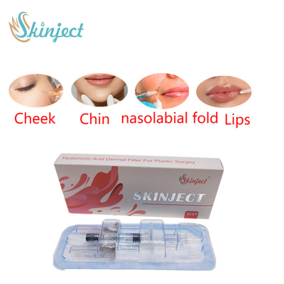 Створка Chin вводимой щеки заполнителей губ 2ml Skinject глубокой HA дермальной Nasolabial