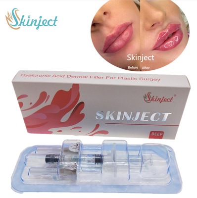 Створка Chin вводимой щеки заполнителей губ 2ml Skinject глубокой HA дермальной Nasolabial