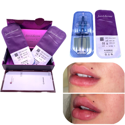 Повышение губы Juvederm 2x1ml заполнителя Ha впрыски извлекает морщинки