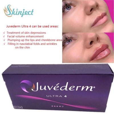 Вводимое заполнителей губы ухода за лицом 2x1ml Juvederm Hyaluronic кисловочное дермальное