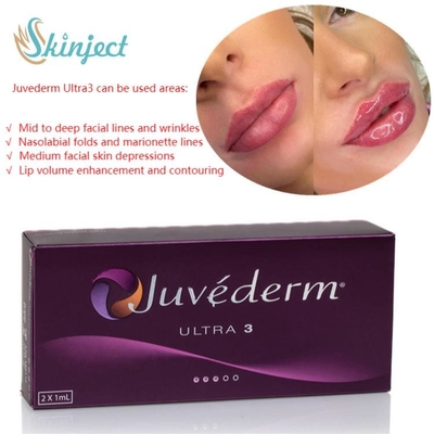 Вводимое заполнителей губы ухода за лицом 2x1ml Juvederm Hyaluronic кисловочное дермальное
