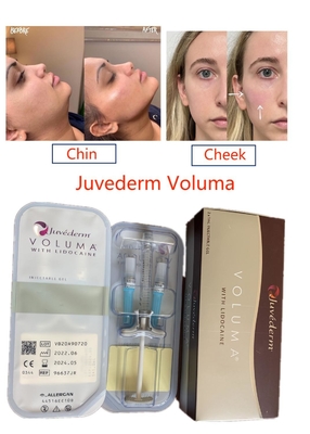 Juvederm Voluma Crosslinked Hyaluronic кисловочное вводимое продолжительной стороны заполнителя чистое
