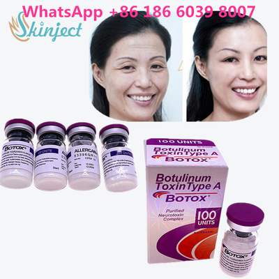 Botulinum токсин  сморщивает удаление 100u Allergan 100 блоков для впрыски подтяжки лица