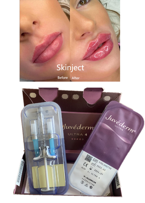 Вводимая глубокая Hyaluronic кисловочная створка Chin дермальной щеки заполнителя губы 2ml Nasolabial