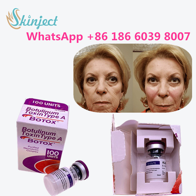 продукты allergan botulinum токсина анти- старея печатают токсину анти- морщинку