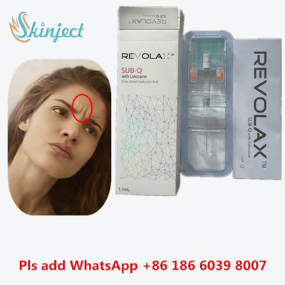 Hyaluronic кисловочный дермальный штраф Revolax заполнителя для лицевых морщинок