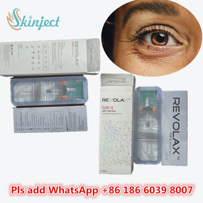 Hyaluronic кисловочная пластмасса заполнителя KOEAR Revolax ручки Hyaluronic кисловочная дермальная лицевая