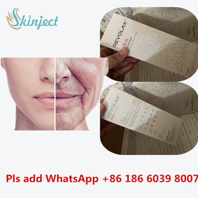 Hyaluronic кисловочный дермальный заполнитель 1ml Revolax глубокий для впрыски губ