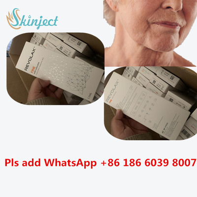 Hyaluronic кисловочный дермальный заполнитель 1ml Revolax глубокий для впрыски губ