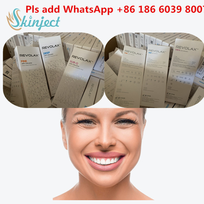 Hyaluronic кисловочный дермальный заполнитель 1ml Revolax глубокий для впрыски губ