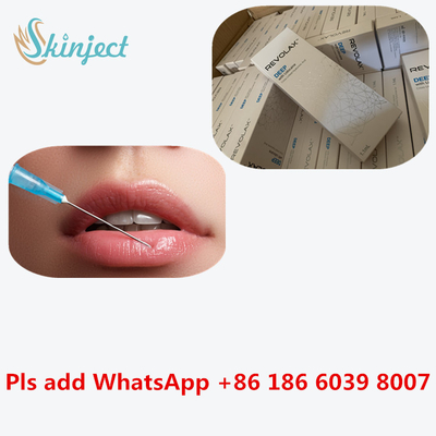 Вводимый дермальный заполнитель Revolax 24 Mg/Ml впрыска HA Hyaluronic кисловочная