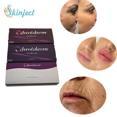 Крест 2 Ml Juvederm соединил Hyaluronic кисловочный заполнитель ультра 3 ультра 4 Voluma