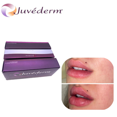 Juvederm Гиалуроновая кислота Увеличение губ Дермальное наполнитель Лифтинг носа Наполнитель длится до лица