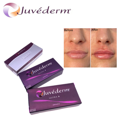 Гилуроновая кислота Dermal Filler Premium Juvederm HA Facial Filler Ultra3 Ultra4 Voluma Для омоложения лица