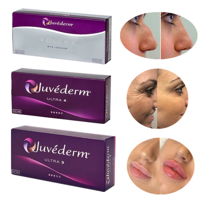 Juvederm 8-12 Hyaluronic кисловочного месяцев продукта дермального заполнителя революционного вводимого