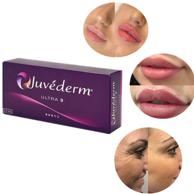 Сейф Crosslinked дермальный Hyaluronic кисловочный заполнитель для всех типов кожи