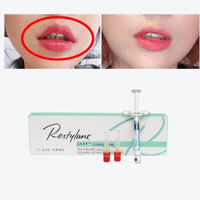 Vital  Perlane Cross Linked Dermal Filler Гиалуроновая кислота