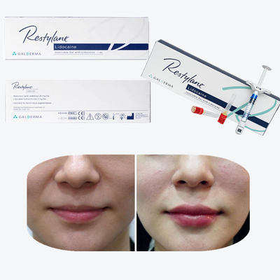 Vital  Perlane Cross Linked Dermal Filler Гиалуроновая кислота