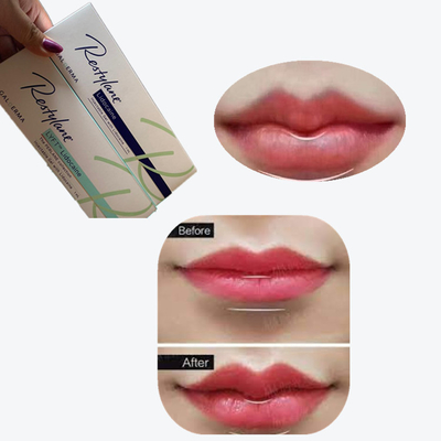 2*1мл/ коробка Кроссосвязанный дермальный наполнитель для увеличения губ