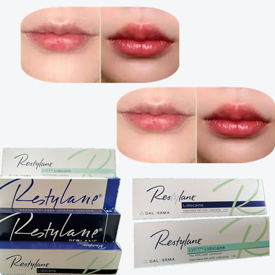 2*1мл/ коробка Кроссосвязанный дермальный наполнитель для увеличения губ