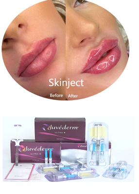 Juvederm Гиалуроновая кислота для покрытия кожи для лица Инъекционный препарат 2*1 мл Упаковка