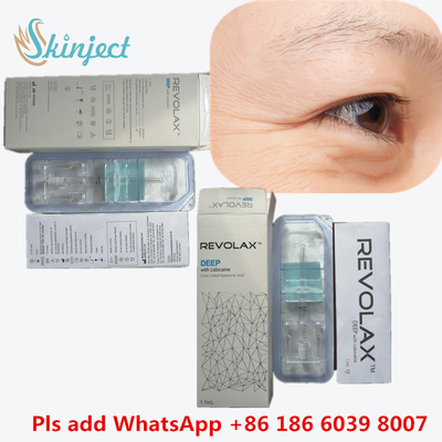 Инъекционный гиалуроновый кислота Dermal Filler 1 мл Derm Lines Пластическая хирургия