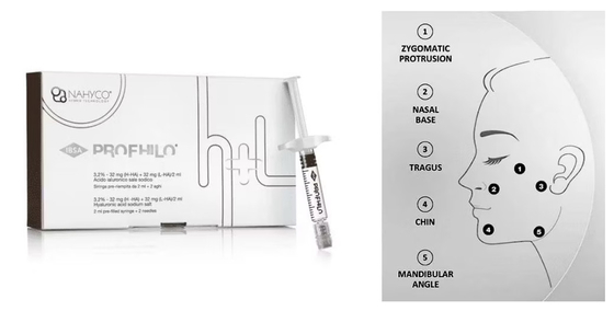 Естественный лифтинг 5-точечной иглой, инъекционный дермальный филлер Profhilo