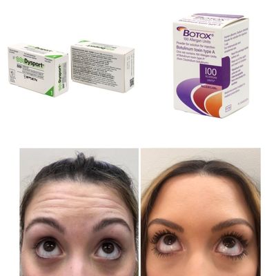 100 единиц Корея BTX Ботулинический токсин для морщин и тонких линий
