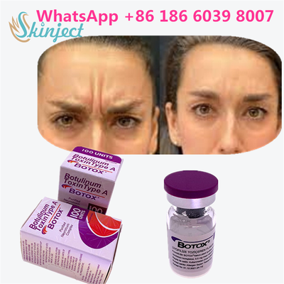 Ботулинический токсин BOTOX Cosmetic 100 Единиц Allergan ОнаботулотоксинА для мимических морщин