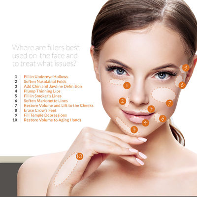Морщинка лба впрыски заполнителя геля Skinject Hyaluronic кисловочная извлекает