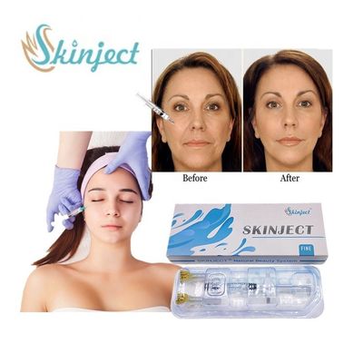 Впрыски морщинки заполнителя Skinject 1ml точный Hyaluronic кисловочный анти- старея заполнитель анти- дермальный
