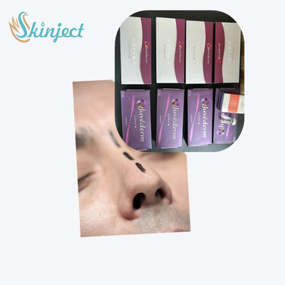 Крест соединил Hyaluronic кисловочный дермальный заполнитель Juvederm ультра 3 ультра 4 Voluma