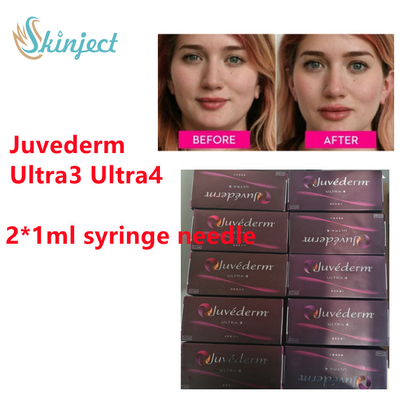 Заполнитель губы Juvederm заполнителя Juvederm Hyaluronic кисловочный дермальный с  2x1ml Ultra3 Ultra4
