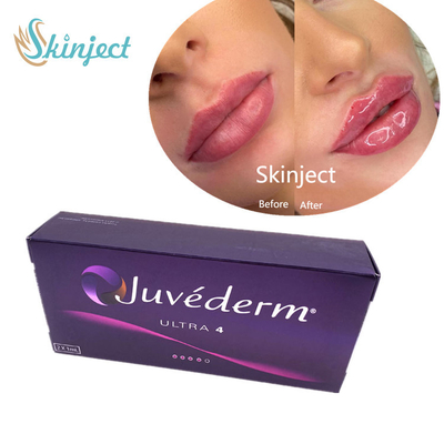 Заполнитель заполнителя губ Juvederm 2*1ml Hyaluronic кисловочный дермальный с Lido Ultra4