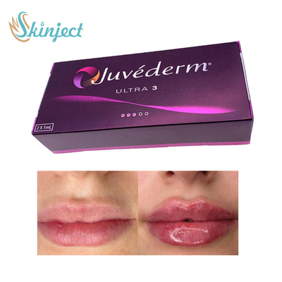Hyaluronic кисловочный заполнитель Juvederm Ultra3 губы 281ML дермальное