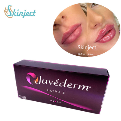 Заполнители Juvederm Ultra3 2x1ml Hyaluronic кисловочные лицевые дермальные