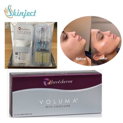 Кислота дермального заполнителя Juvederm Voluma Hyaluronic для лицевого контура Chin щеки