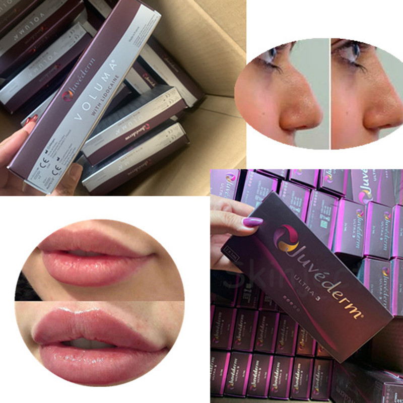2 заполнитель ML Juvederm ультра 4 Hyaluronic кисловочный дермальный для сексуального повышения губ