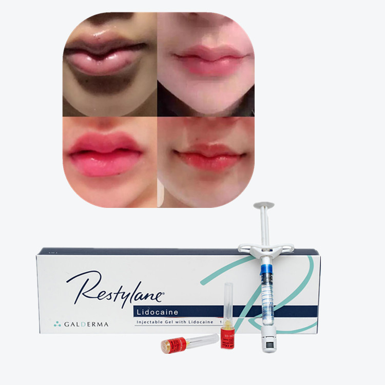 Juvederm Cross Linked Injectable Dermal Filler для губ