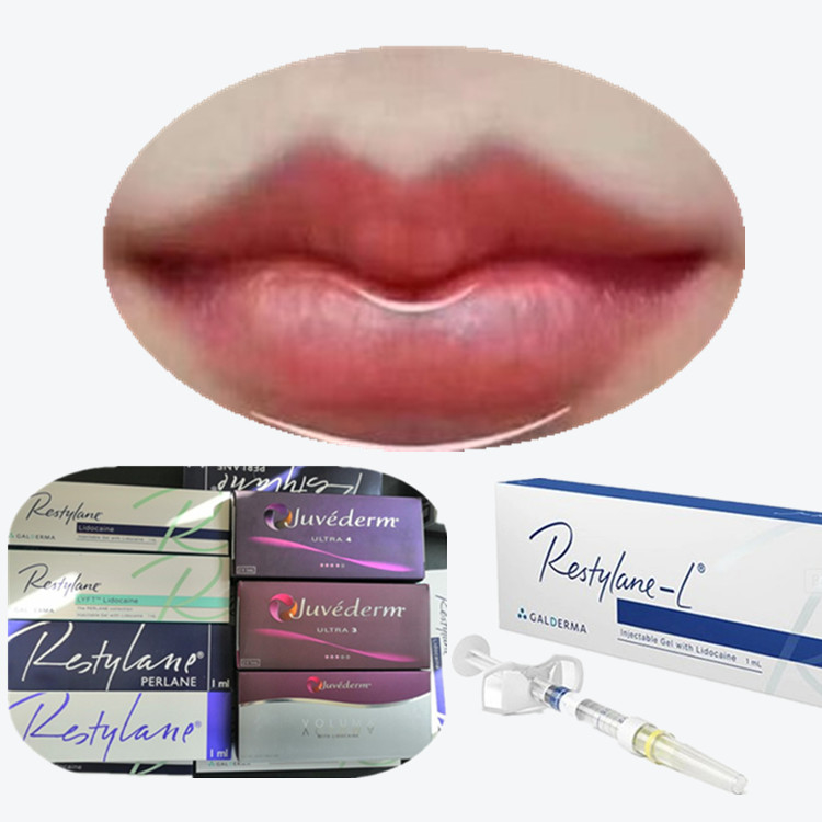 Инъекционный гиалуроновый кислотный наполнитель для лица LIDO LYFT Dermal Fillers