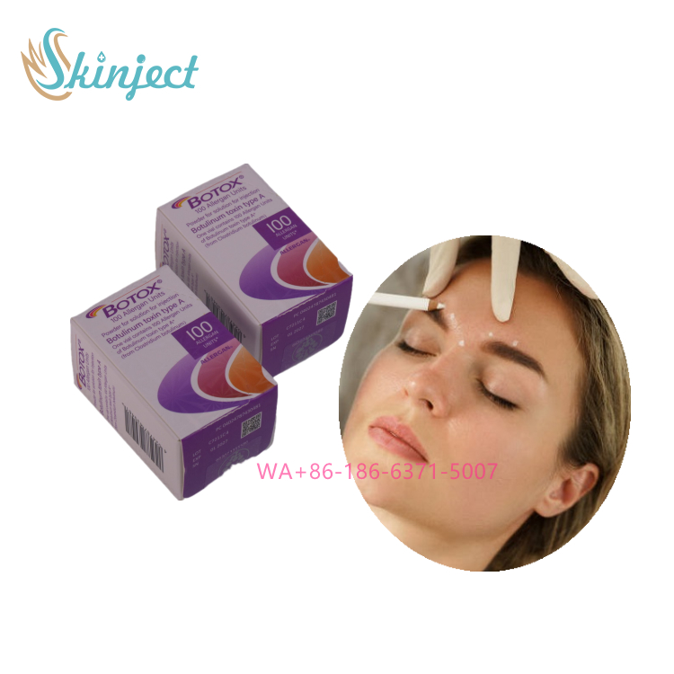 Allergan Botox 100IU для инъекций для уменьшения морщин, разглаживания морщин на лбу, лечение ботулотоксином для гладкости