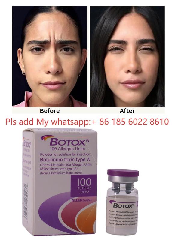 ALLERGAN Botox Injection Botulinum Toxin Type A