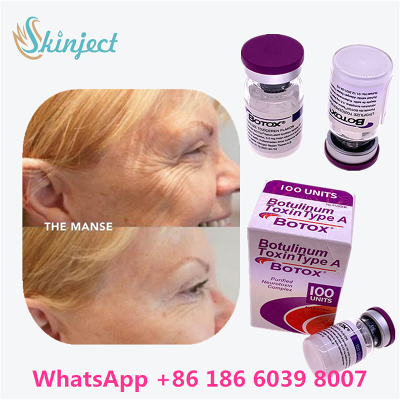 Ботулинический токсин BOTOX Cosmetic 100 Единиц Allergan ОнаботулотоксинА для мимических морщин