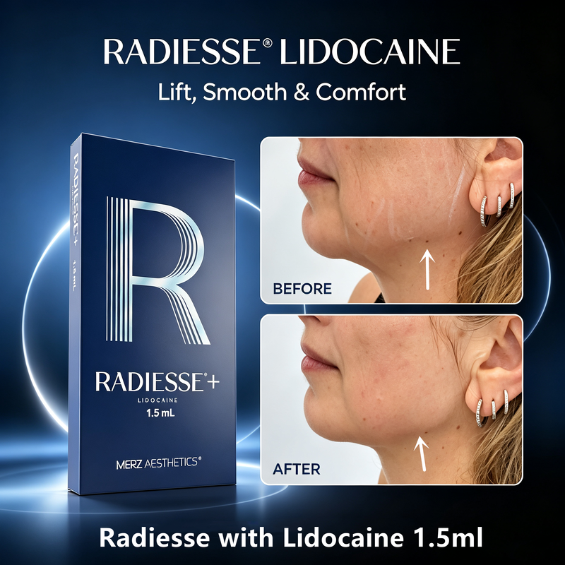 Radiesse+ Lid0 1.5ml Dermal Filler CaHA Collagen Biostimulator for Facial Anti‑Aging & Jawline Shaping