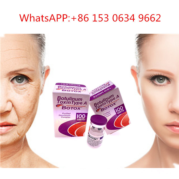 тип 50u 100u 150u токсин впрыски Allergan  Botulinum для анти- морщинки