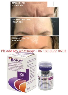 Allergan Botox 100IU Dysport Инъекция Ботулакс Ботулинический токсин Удаление морщин